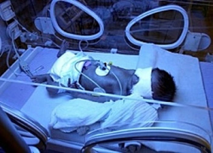 Brescia, neonato muore in ospedale per un misterioso batterio