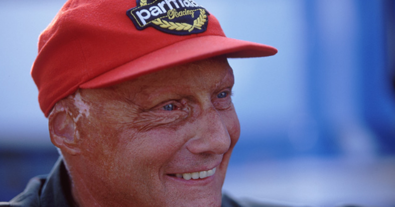 Niki Lauda è uscito dal coma artificiale