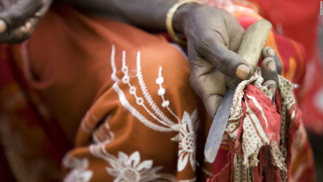 Somalia to pursue first FGM prosecution after 10-year-old girl dies