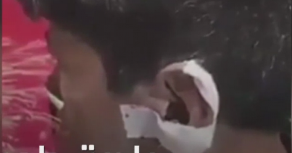 Orrore a Teheran: la municipalità taglia l’orecchio di un bambino che guarda nella spazzatura