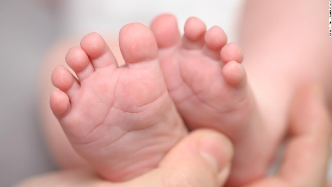 France launches nationwide investigation after babies born with missing or malformed limbs